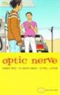 OPTIC NERVE #3
